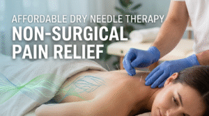 Affordable Dry Needle Therapy – Non-Surgical Pain Relief