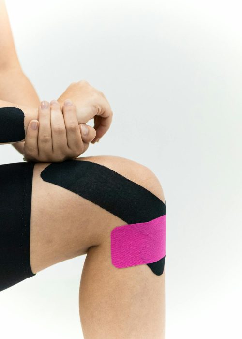 Supportive K-Taping Therapy